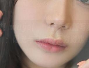 First Image